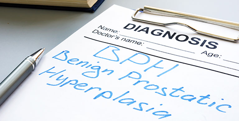 Prostate Enlargement or BPH Benign prostatic hyperplasia diagnosis